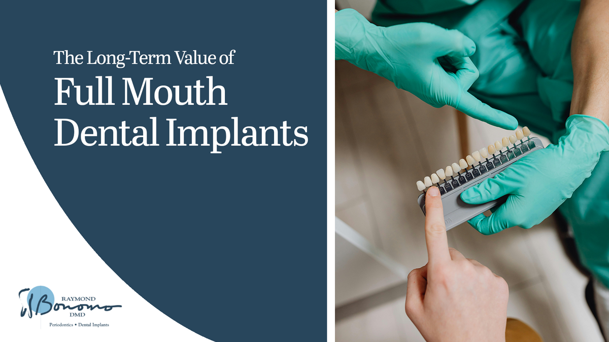 gloved hands hold a dental shade guide and another hand is point to one display tooth text reads The long term value of full mouth dental implants